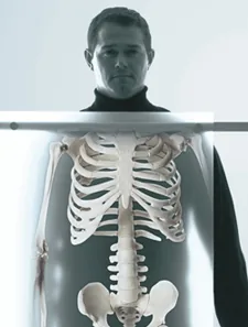 Chiropractors want X-ray views showing your body in a weight-bearing position. Man getting an X-ray